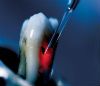 laser dentistry image