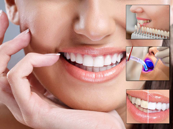 Cosmetic Dental Treatments in Madurai | Dental Care Madurai